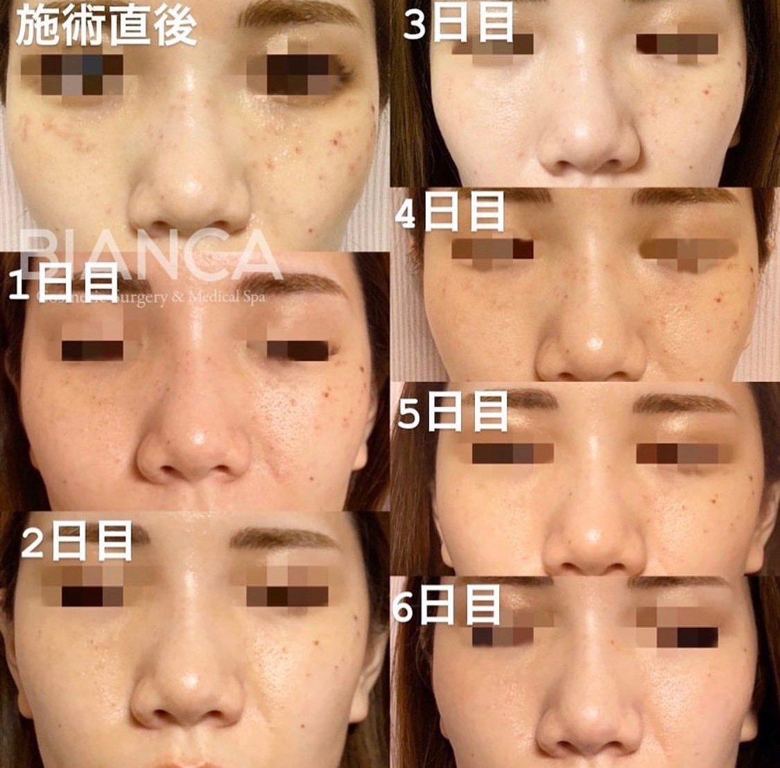 症例画像