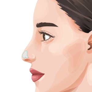 auricular cartilage transplantation