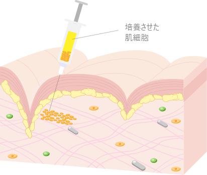 真皮線維芽細胞療法｜ビアンカ銀座｜日本を代表する美容健康再生医療のクリニック