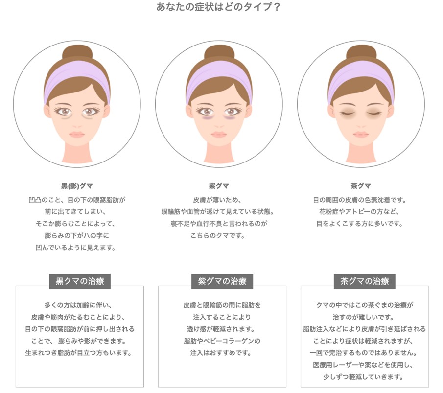 目の下クマ・たるみ取り（経結膜脱脂術）