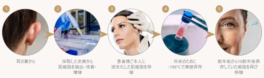 真皮線維芽細胞療法｜ビアンカ銀座｜日本を代表する美容健康再生医療のクリニック