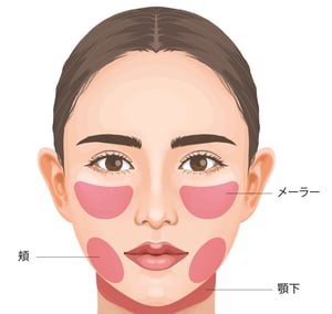 トータルフェイスサクション｜ビアンカ銀座｜日本を代表する美容健康再生医療のクリニック