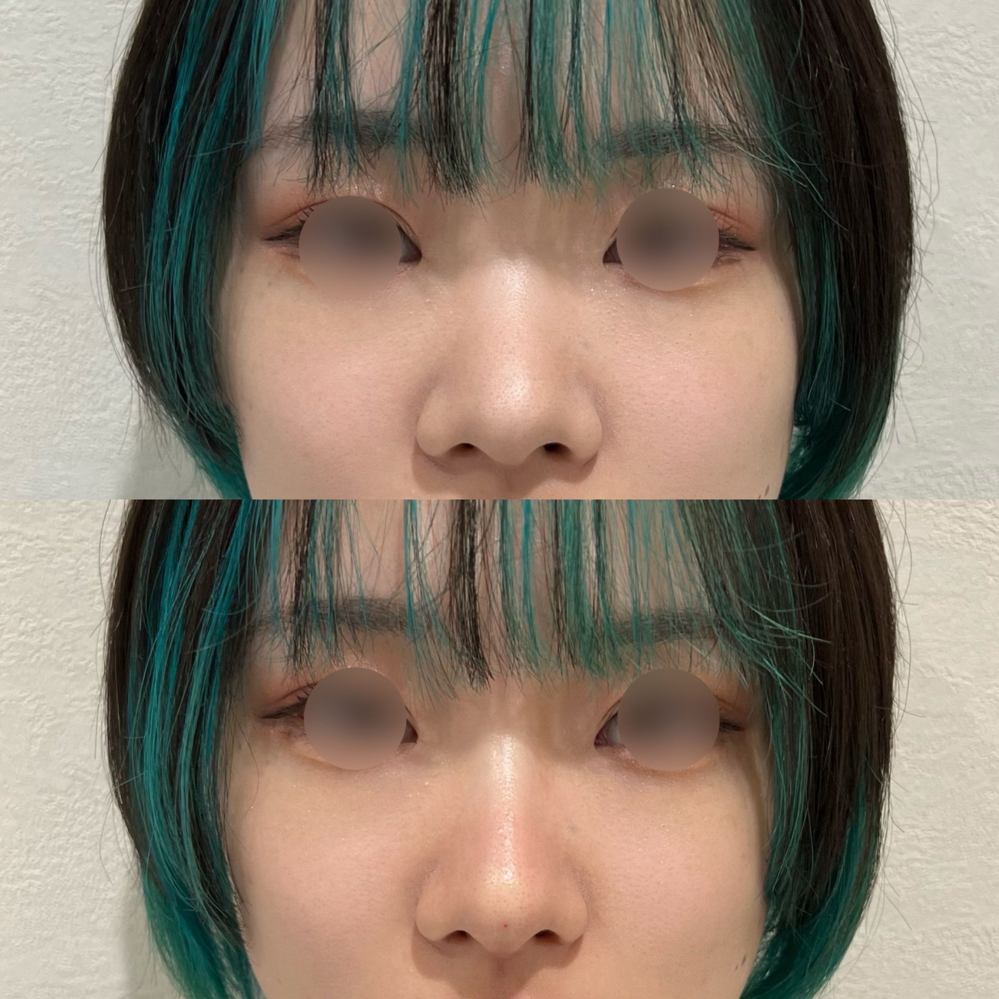 症例画像
