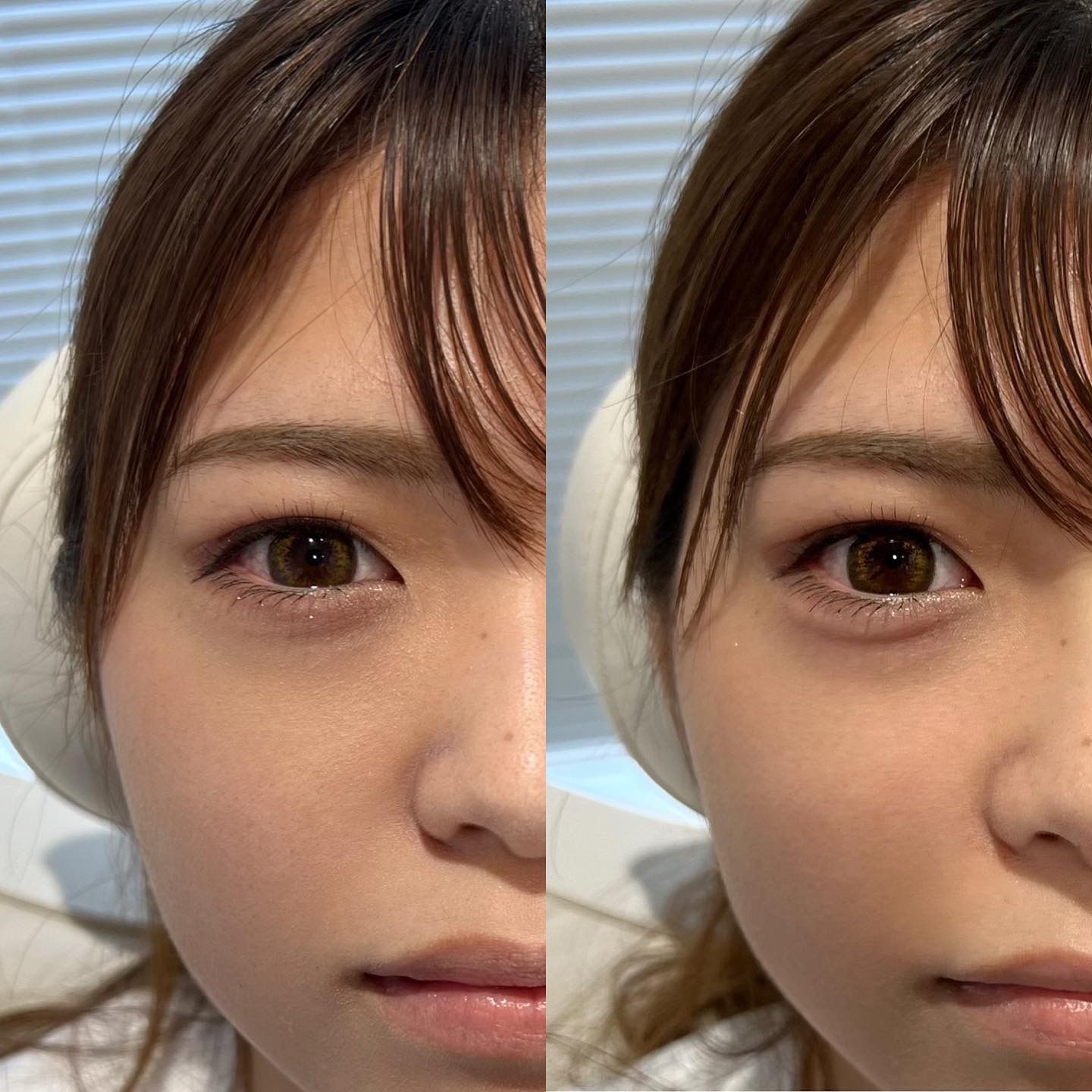 症例画像