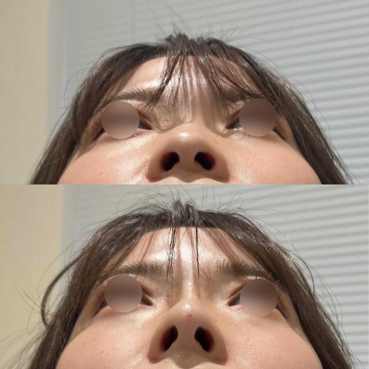 症例画像