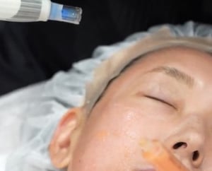ナノステムビアンカ銀座｜日本を代表する美容健康再生医療のクリニック