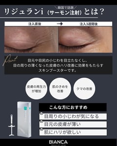 目元の小じわに対するリジュランiの症例
