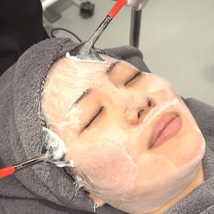 ララピール-ピーリングを皮膚科で受けるならどれ?あなたの肌悩みに合った選び方教えます【医師監修】