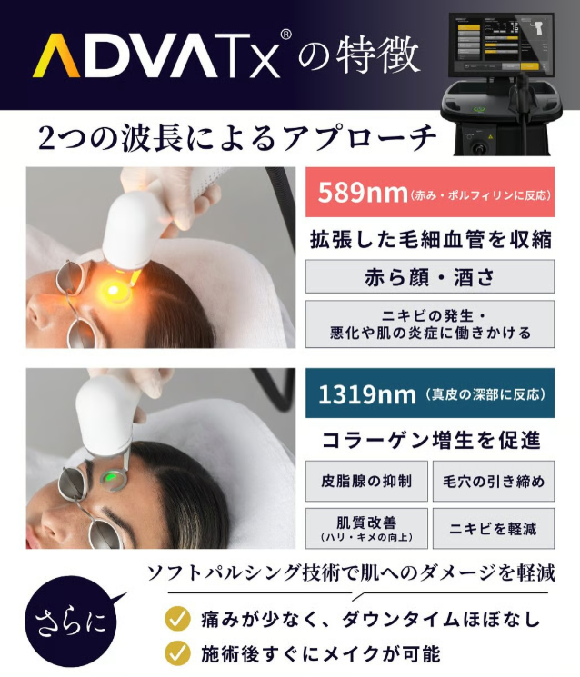 アドバテックスレーザーは赤ら顔治療の新しい選択肢 | 日本を代表する
