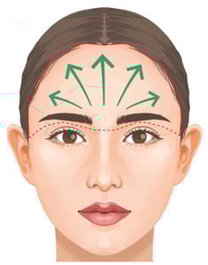 前額リフト　ビアンカ銀座｜日本を代表する美容健康再生医療のクリニック